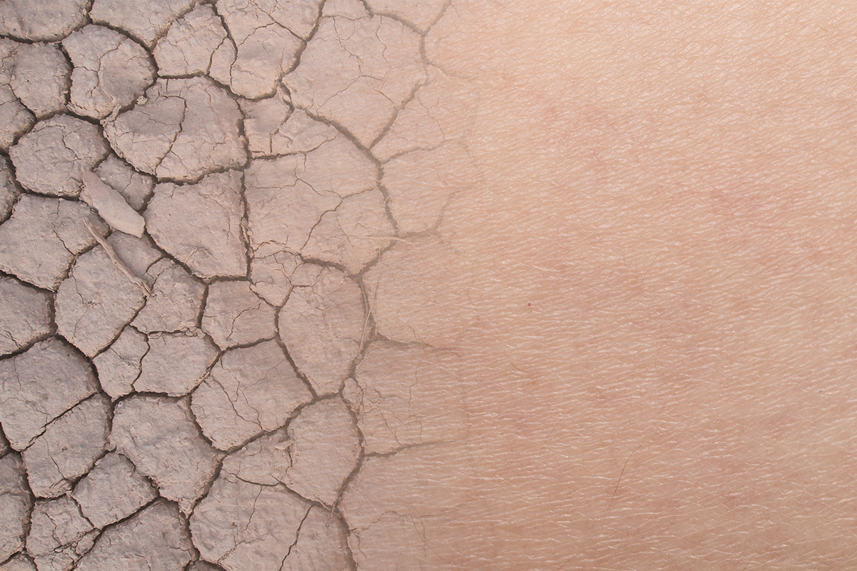 Best Moisturizer for Dry Skin