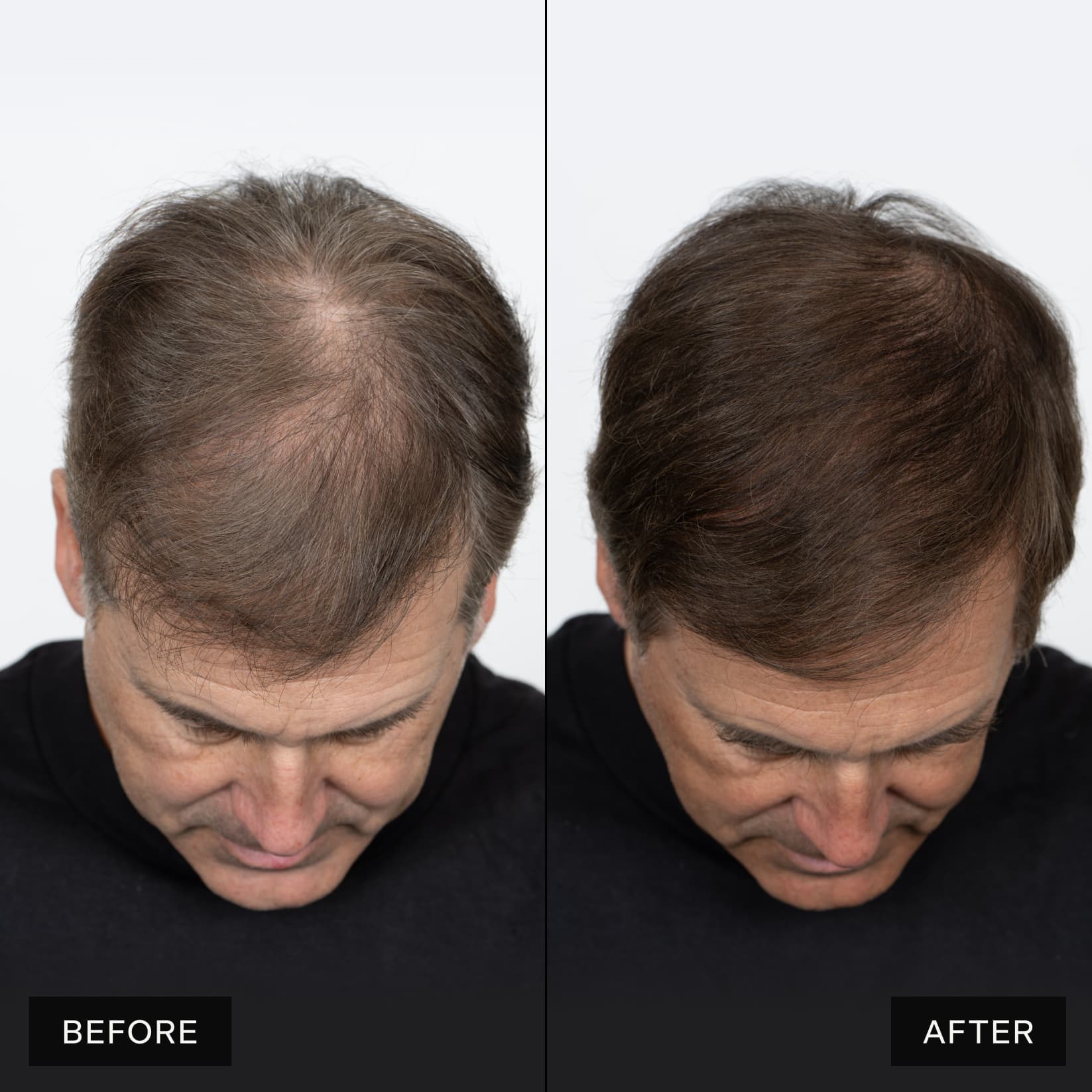 Hair Care 1